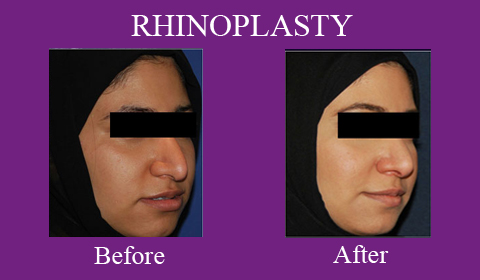 Plastic Surgery in Bilaspur Chhattisgarh