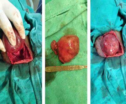 Rudra ENT Hospital treatment