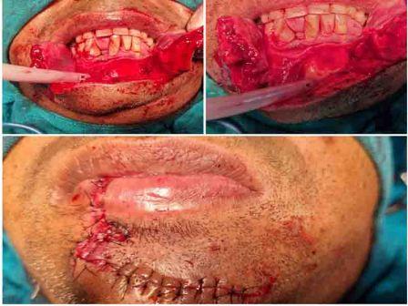 Rudra ENT Hospital treatment