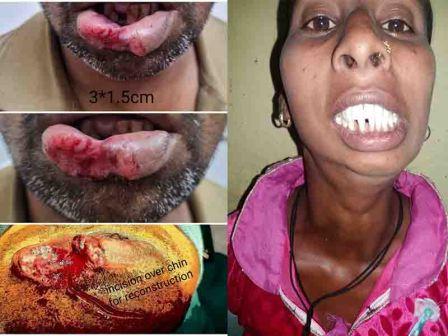 Rudra ENT Hospital treatment