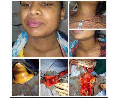Rudra ENT Hospital treatment